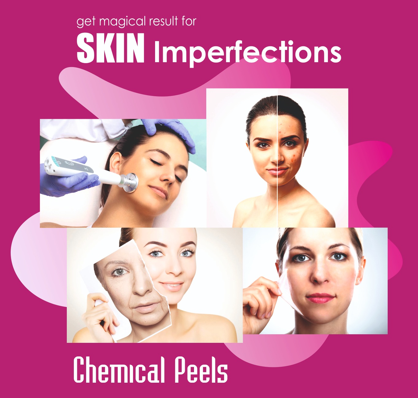 Skin Whitening