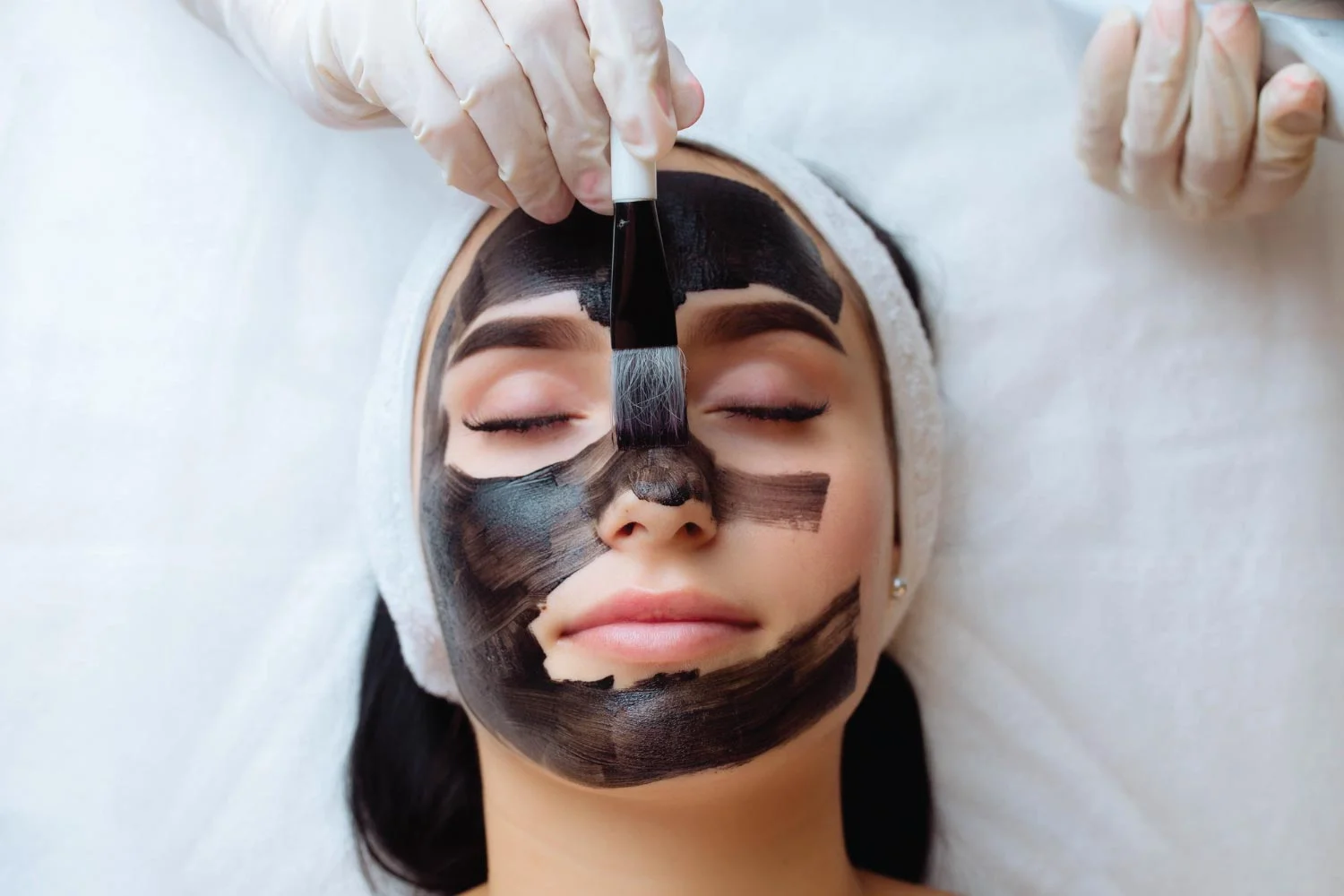 Carbon Peel