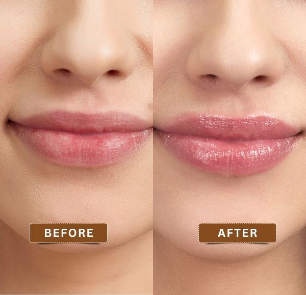 Lip Lightening