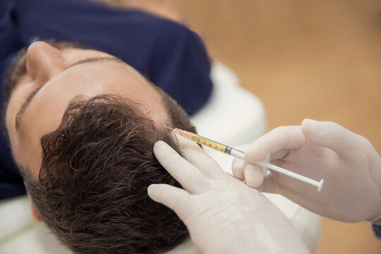 PRP Hair Treatment